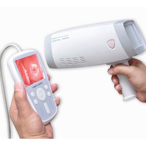 Handheld Portable HD Vagina Camera For Gynecology Colposcope Camera Gynecological