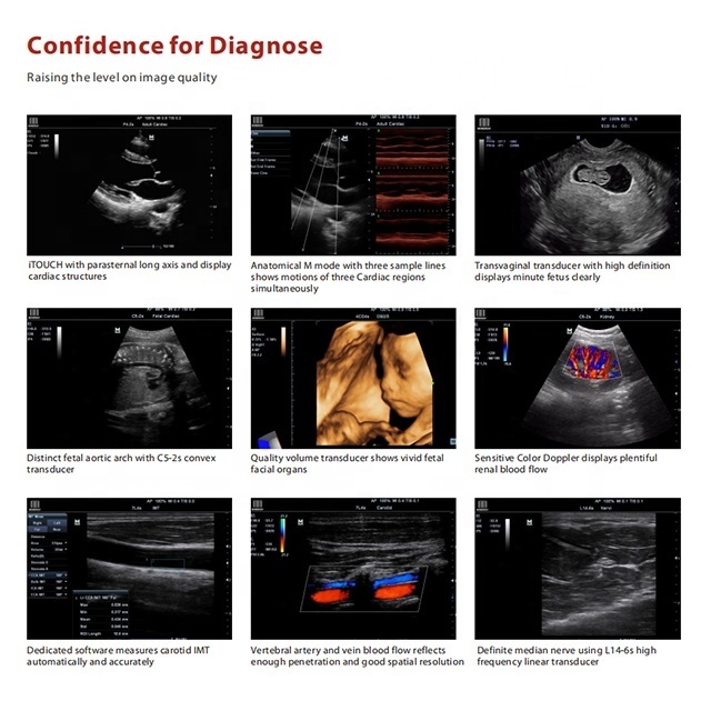 4D portable ultrasound machine ecografo mindray m7 m9