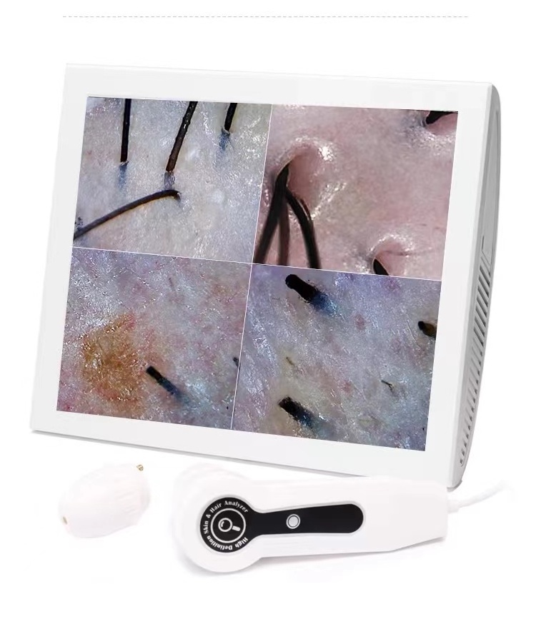 2024 new 15-inch digital HD hair follicle detection, detection of skin problems hair skin analyzer