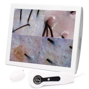 2024 new 15-inch digital HD hair follicle detection, detection of skin problems hair skin analyzer