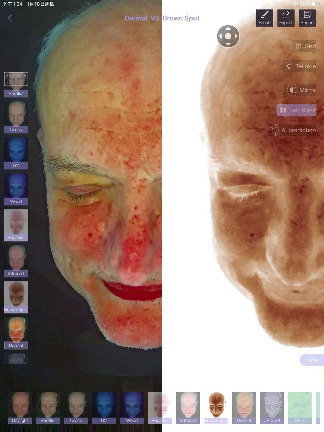 New product Facial Skin Analyzer Digital facial skin analyzer at beauty salons BV skin analyzer