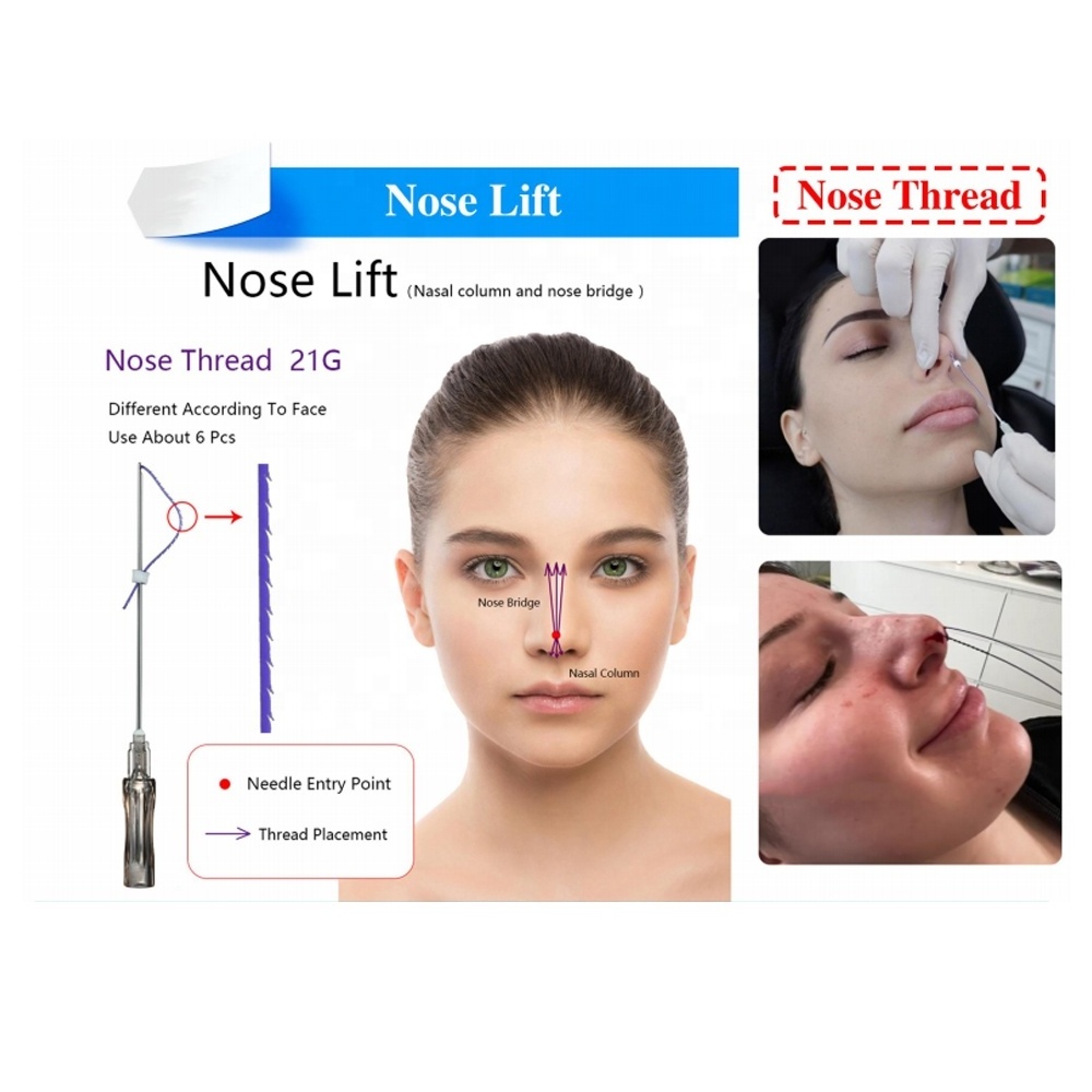 Korean Thread Skin Care 19g 38mm L Cannula Nose-Tip Lifting Nose Cog Pdo Thread Face Lift