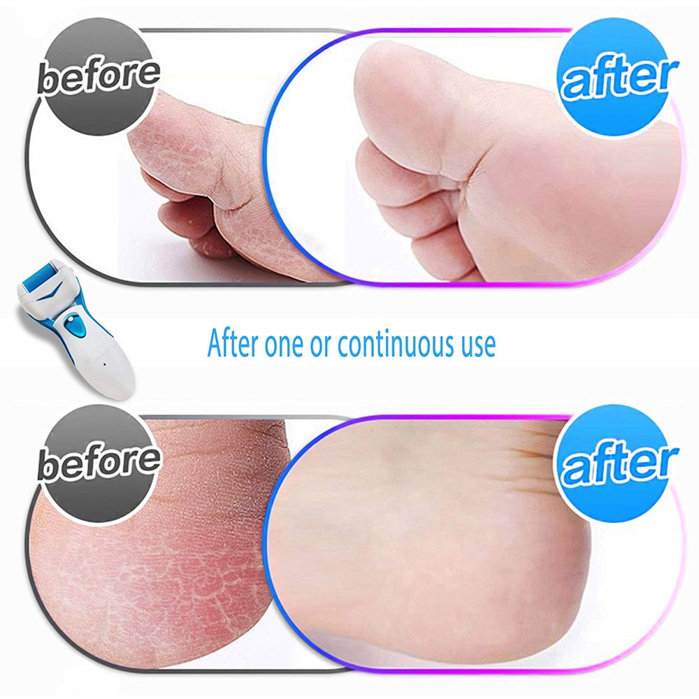 Ins Trendy 2 in 1 Electric Callus Remover with Interchangeable Personal Rechargeable Foot File Callus Remover Electric Pedicure