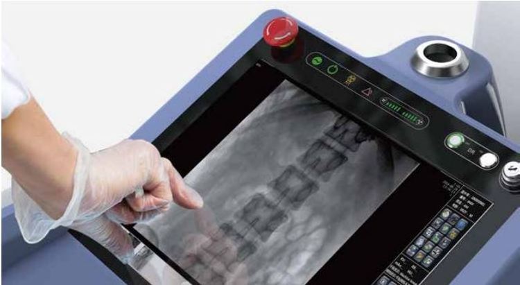 Medical diagnostic radiology equipment 25 kW Mobile Digital X-Ray Machine