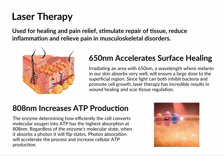 808nm 650nm High Intensity MLS Class 4 Laser Therapy Laser Treatment for Pain and Inflammation Plantar Fasciitis At Home