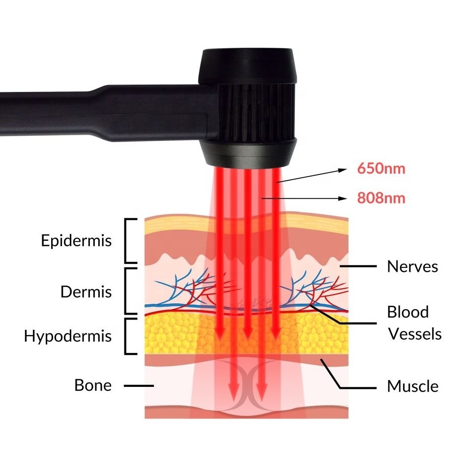 Light therapy chiropractic laser therapy class 3b health machine