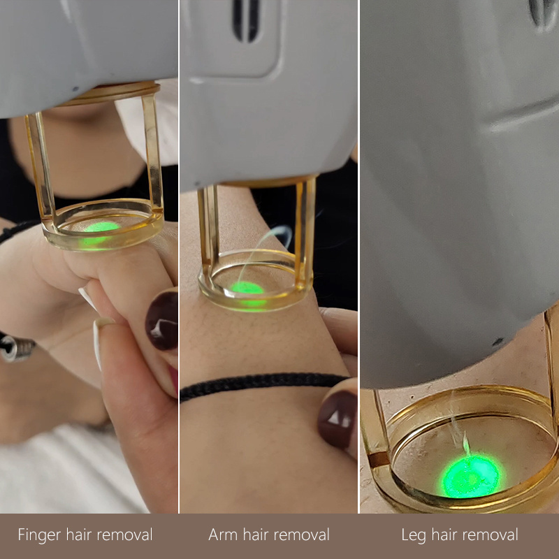 755nm Alexandrite Laser 1064nm Long Pulse Nd Yag Laser Hair Removal Alexandrite Laser Candle