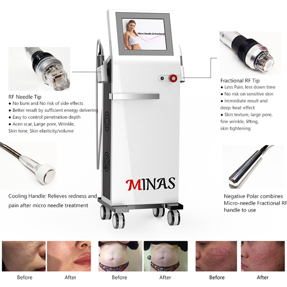 Clinic Use Secret Skin Tightening RF Vivace Microneedling Machine