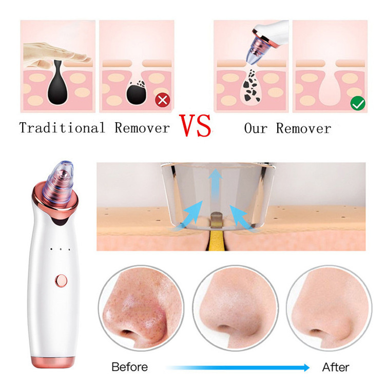 Factory Direct Sales Electric Nose Pore Vacuum Blackhead Remover Device Remove Blackhead Microdermabrasion Machine