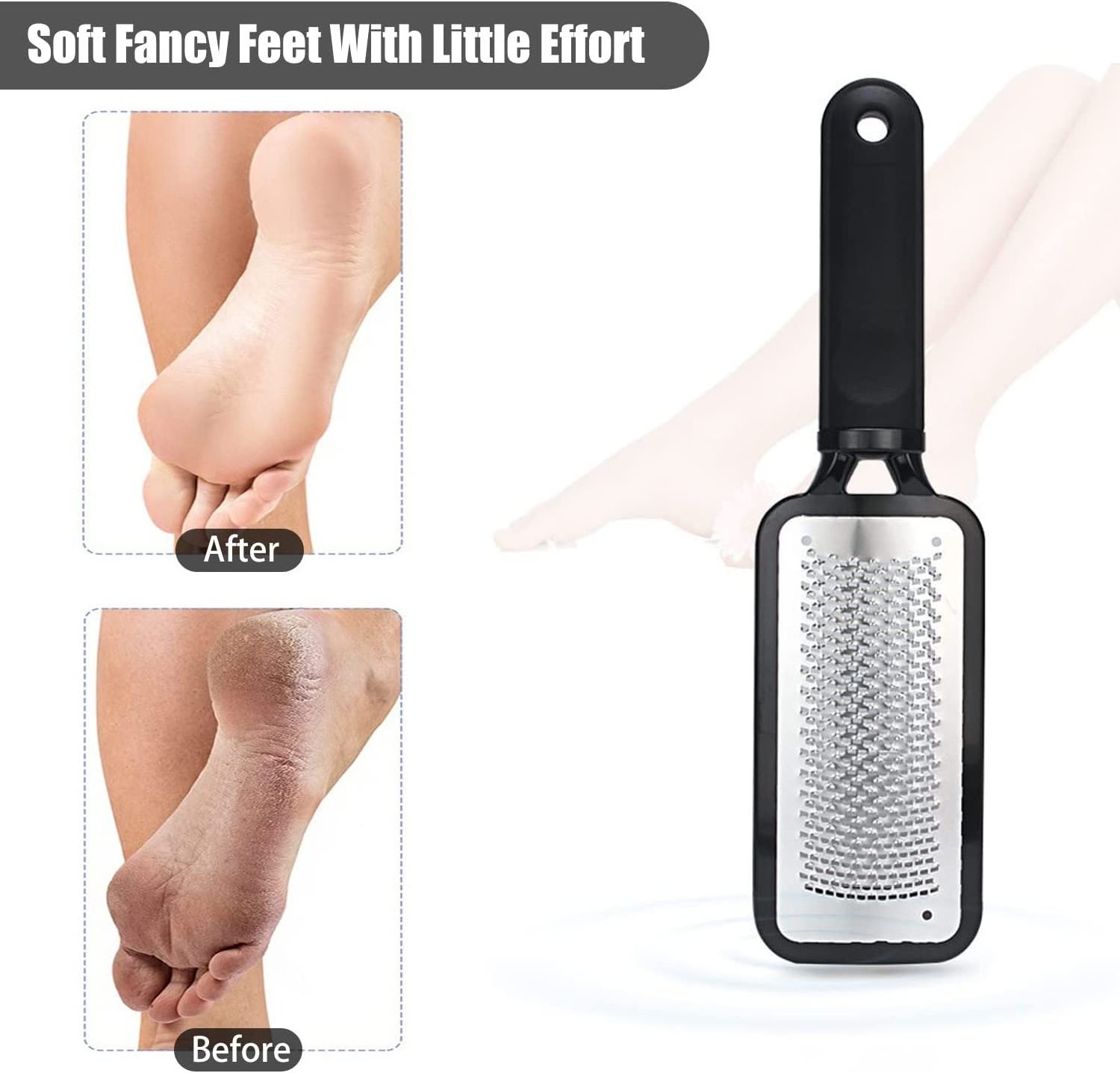 Foot Scrubber Callus Remover for Feet Colossal Foot Rasp Callous File Dead Skin Remover Foot Scraper Feet Grater