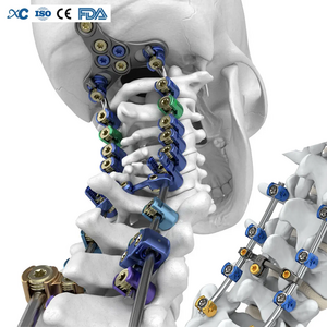 Hospital Grade Spinal Fixation System 5.5 6.0 Pedicle Screw Rod Instrument Sets Lumbar Spinal Orthopedic Implants