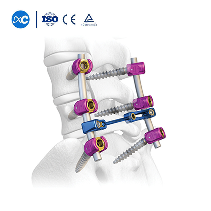 Hospital Grade Spinal Fixation System 5.5 6.0 Pedicle Screw Rod Instrument Sets Lumbar Spinal Orthopedic Implants