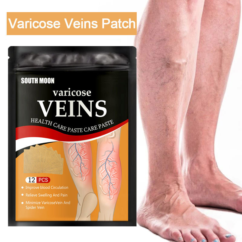 Chinese Herbal Varicose Veins Treatment Patch Strengthen Capillary Health Effective Varicose Medical Plaster