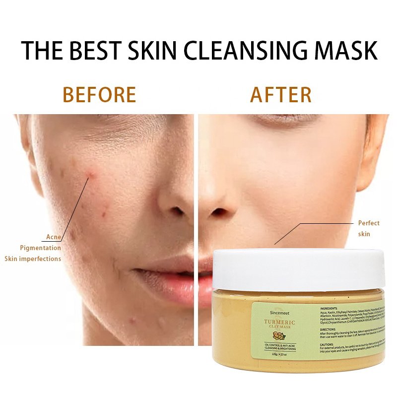 Private label Beauty Face Masks Cosmetic Skincare Collagen Turmeric mud Mask SPA Turmeric clay mask