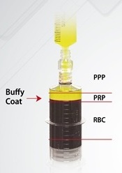 YES PRP KIT, BS PRP KIT Centrifuge