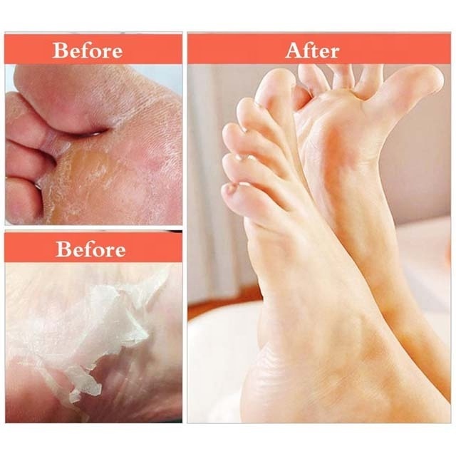 2pcs exfoliating Moisturizing and whitening foot peel mask sheet