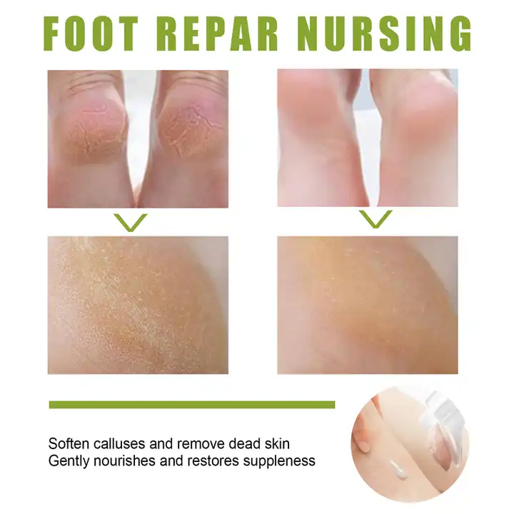 exfoliating Socks Callus Remover Improve foot thickness moisturizing feet mist foot care peeling spray