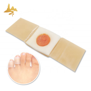 Good Quality Transdermal Patch Salicyl Acid Foot Pain Relief Corn Remover Plaster