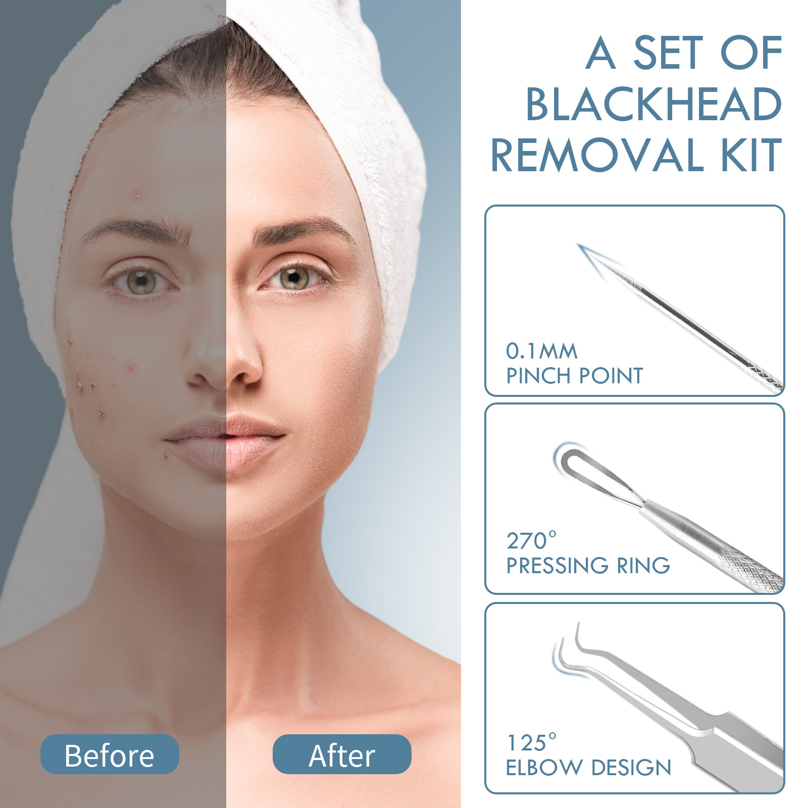 Professional Blackhead Remover Tool Comedones Extractor Acne Removal Kit For Blemish Whitehead Popping