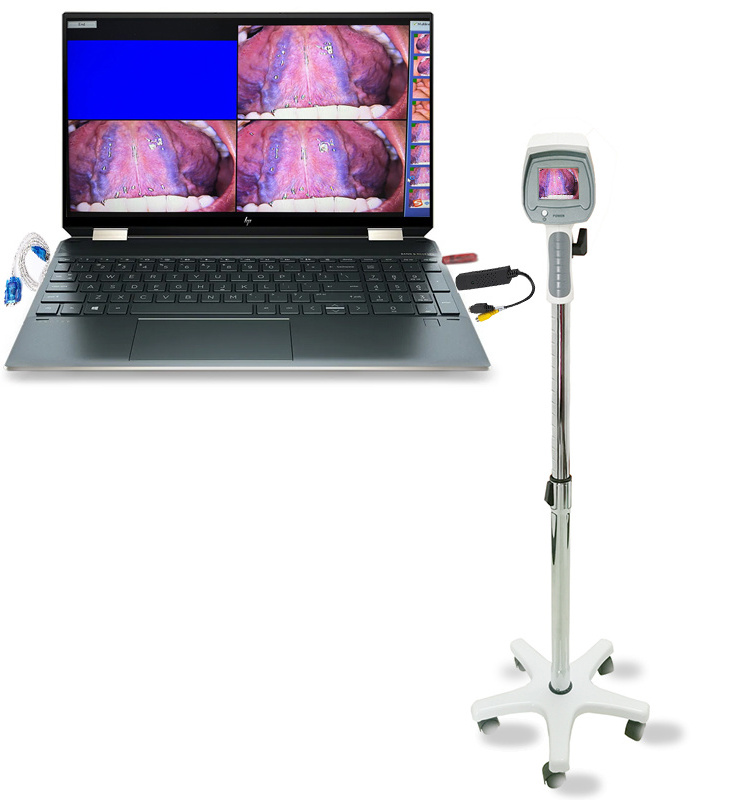 Intelligent HD Video Colposcope Hot Sale Vaginal Camera For Vagina