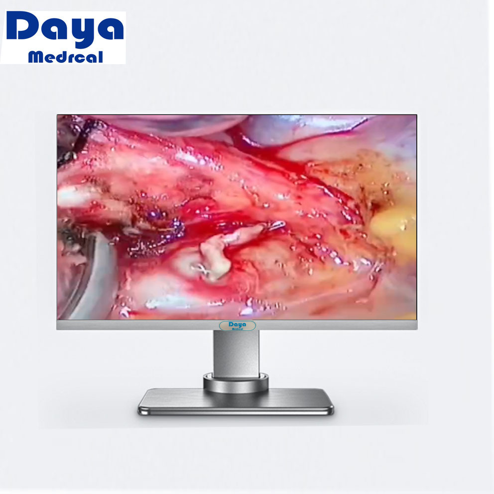 24 inch HD Medical Grade Monitor for Endoscopy Use