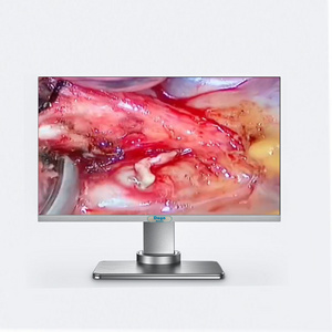 Medical Equipment 27 inch 4k Medical Grade Monitor for Urology Endoscopy Surgery