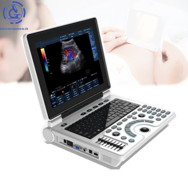 Medical equipment Laptop Color Doppler ultrasound cheaper than Mindray M7