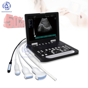 M7 Mindray Professional Portable 3D Color Doppler Ultrasound Machine, ecografo mindray m5 m7 m9 Ultrasound