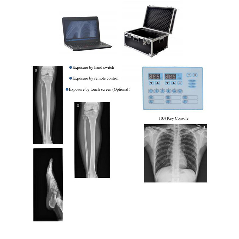 Veterinary Medical High Frequency X Ray Radiography Car Portable Diagnostic Equipment Digital Mobile DR Xray Machine