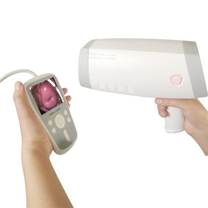 Digital Electronic Vagina Video Colposcope camera for Gynaecology