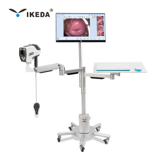 YKD-3003 Digital Full HD Camera for Vagina Colposcope for Gynaecology