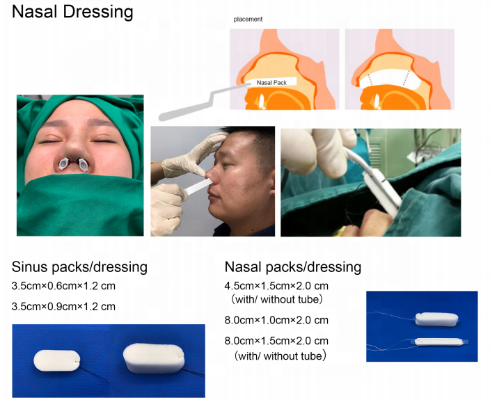 Medical Dissolvable Merocel  Nasal Packing PVA nasal dressing for Septoplasty,ENT