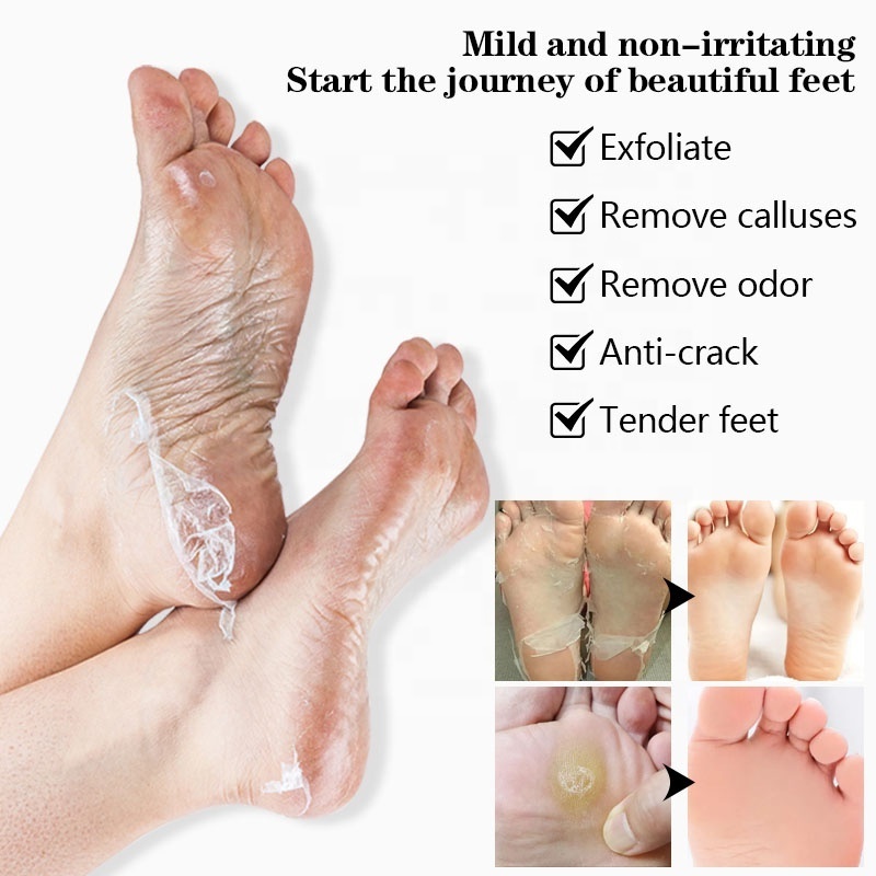 Spa Socks Foot Peel Mask Efero Korea Foot Mask Remove Feet Dead Skin Exfoliating Goat Milk Moisturizing Peeling Foot Mask