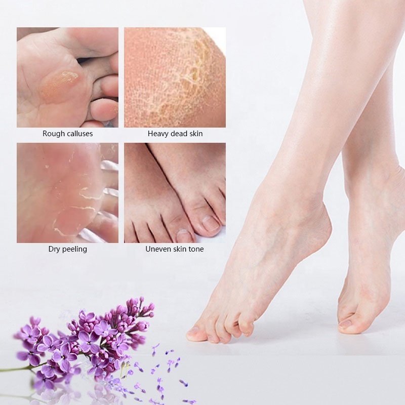 Spa Socks Foot Peel Mask Efero Korea Foot Mask Remove Feet Dead Skin Exfoliating Goat Milk Moisturizing Peeling Foot Mask