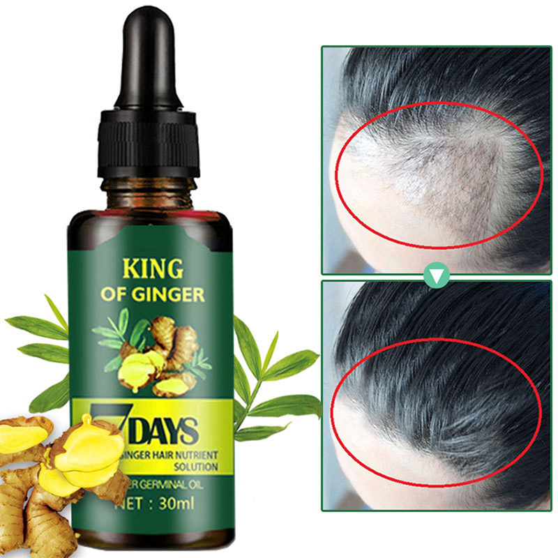 Natural anti loss serum hair growth oil alopecia hair loss treatment products organic herbal ginger regrowth oil