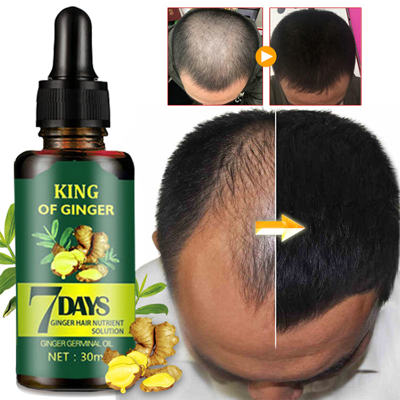 Natural anti loss serum hair growth oil alopecia hair loss treatment products organic herbal ginger regrowth oil