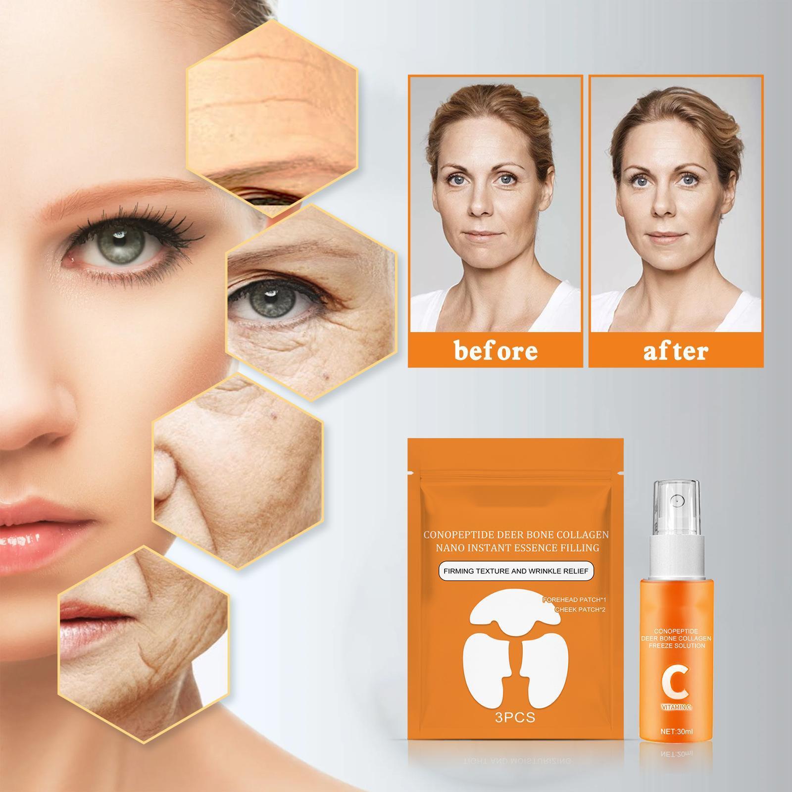 Conotide Deer Collagen Essence set reduces wrinkles, anti-aging, moisturizes and tightens facial skin