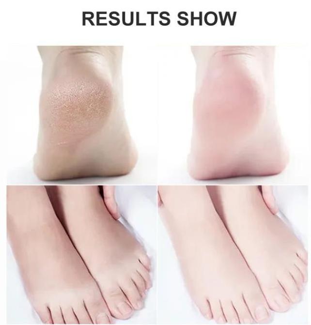 Private Label Foot Scrub Salt Spa Callus Remover Exfoliating Cleansing Hydrating Repair Skincare Organic Bath Salt