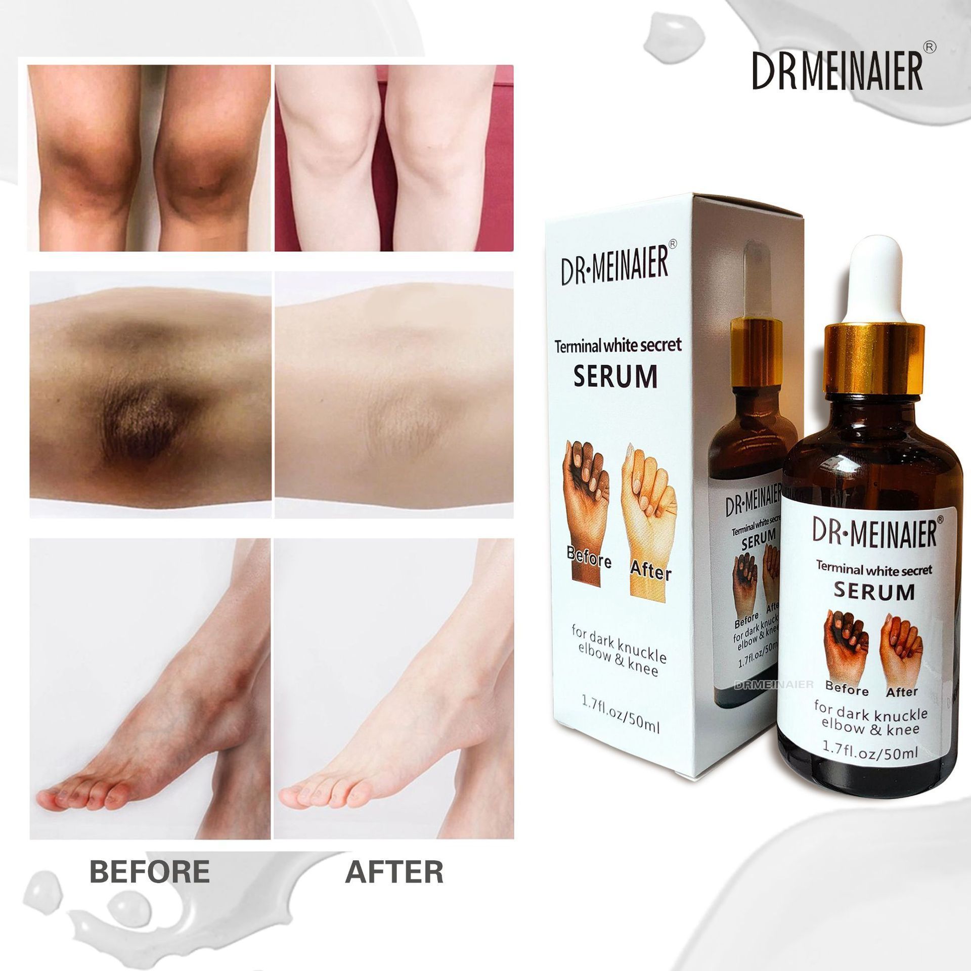 Whitening Serum Hand knuckle Skin Care Glowing Bleaching Serum For Removing Dark Spots Black Knuckle Elbow and Knee 50ml