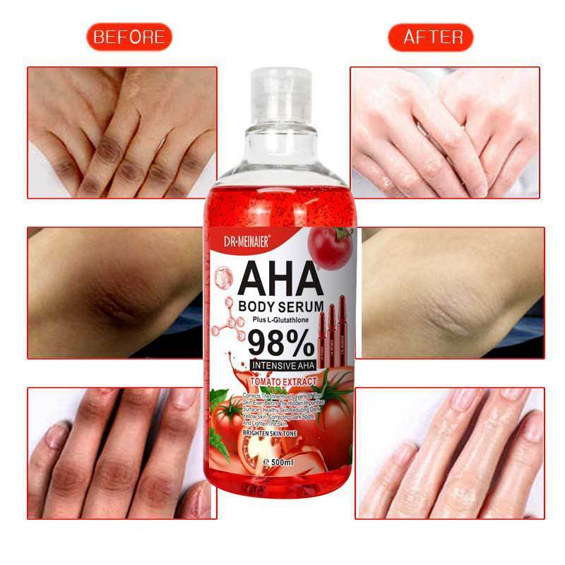 Skin Whitening Serum Face and Body Glowing Moisturizer AHA Tomato Correct Age Spot Acne Natural Facial Serum Essence