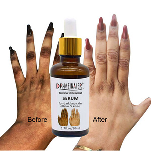 Whitening Serum Hand knuckle Skin Care Glowing Bleaching Serum For Removing Dark Spots Black Knuckle Elbow and Knee 50ml