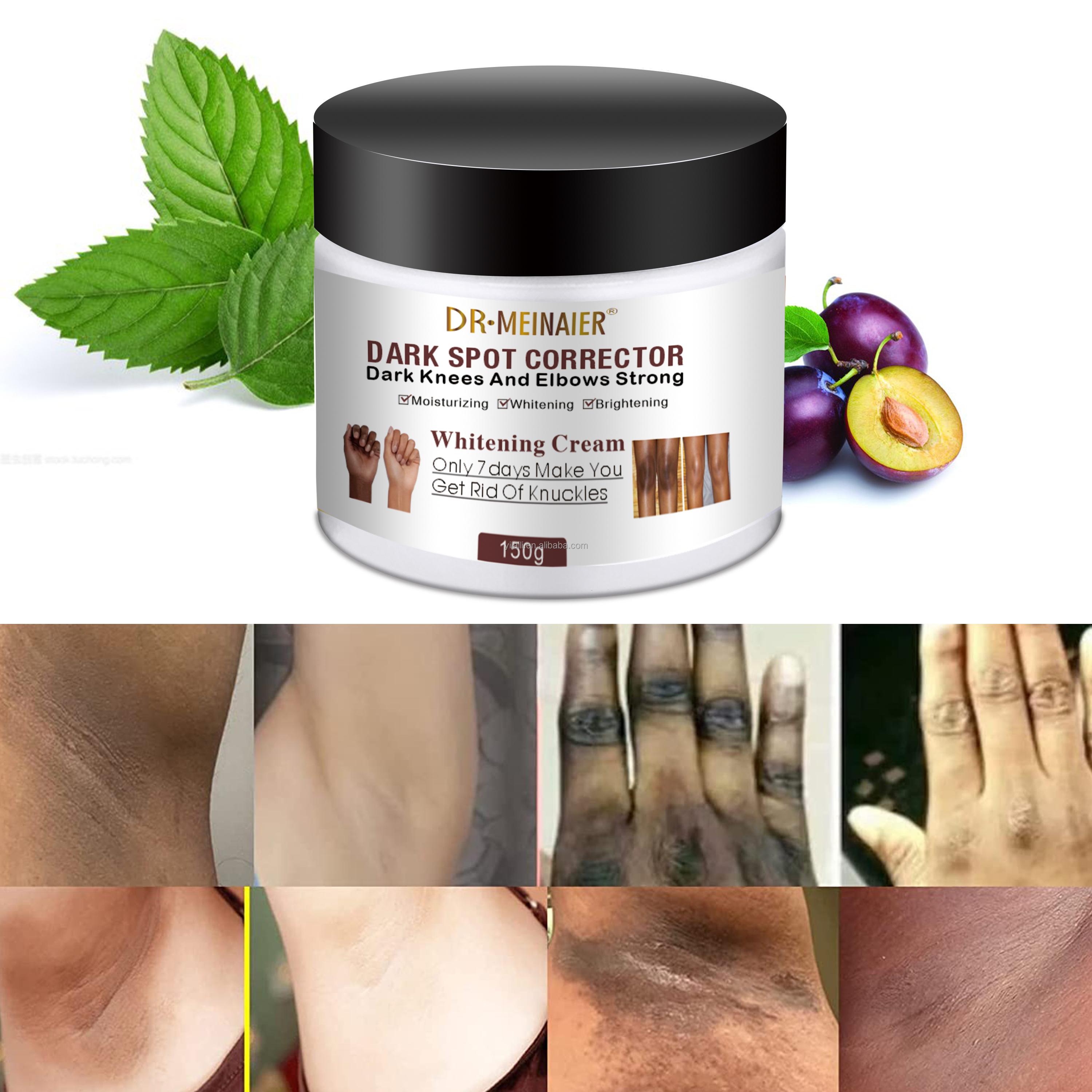 Natural Whitening Cream For Skincare Face Hand Foot Effective Bleaching Cream Remove Spot Freckle Pigmentation Corrector