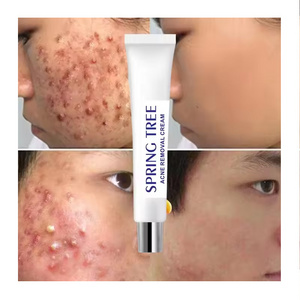 Light Print Scars Removal Face Cream Beauty Pure Skin Care Whitening Facial Moisturizing Cream Acne Treatment Cream