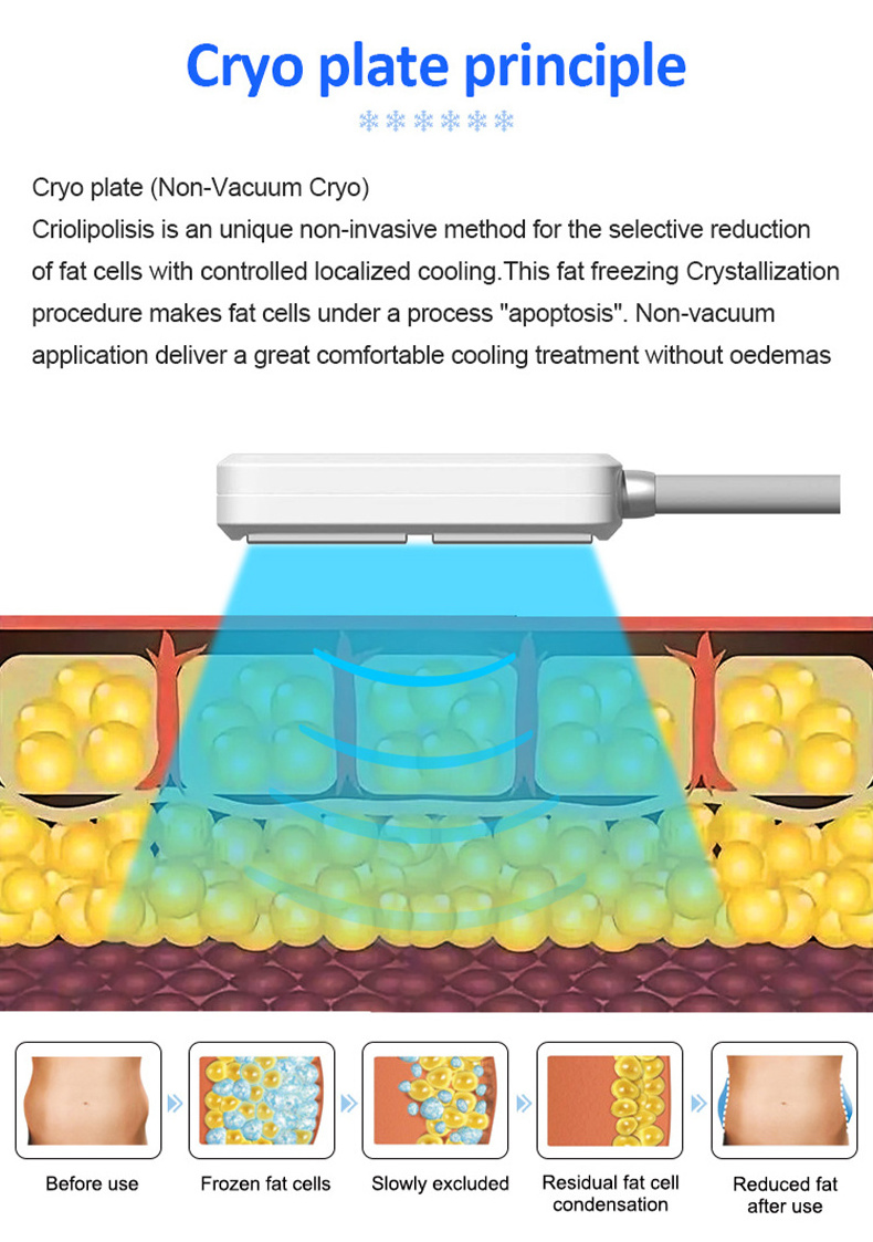 2024 Cryo Pads 4 Cryo Handle Fat Freezing Slimming Machine Cryoskin Ems Slimming Machine With 4 Cryo Handles