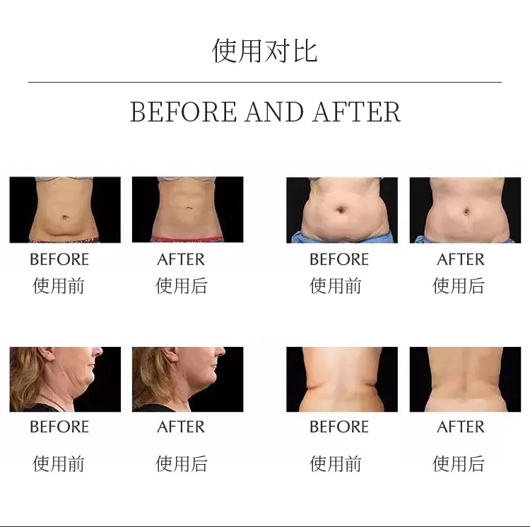 80k cavitation lipo cavitation slimming machine cellulite removal face sculpting 80k cavitation body slimming machine