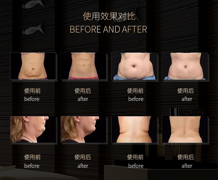 40k Cavitation Machine 9 In 1 Cavitation Ultrasonic Body Slimming Machine 6 In 1  Machine Body Contouring