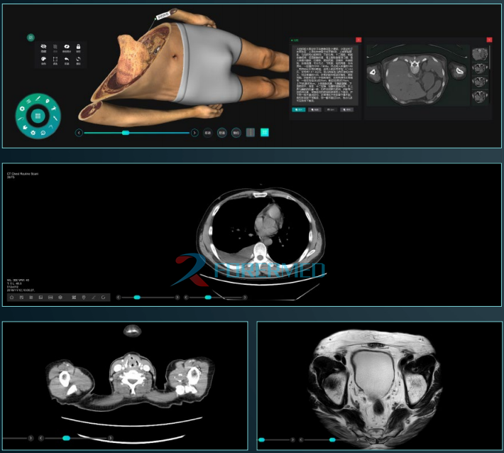 3D Virtual Anatomage Table Autopsy Table 87.8 inches 3D anatomy System with Clinical Case Module 3D Virtual Anatomage Table