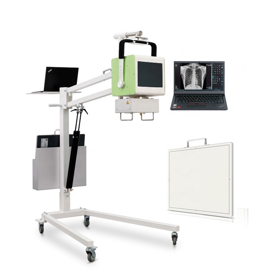 100mA Xray DR 5kW X-ray Unit Medical Radiology Equipment Mobile Digital Portable X Ray Machine