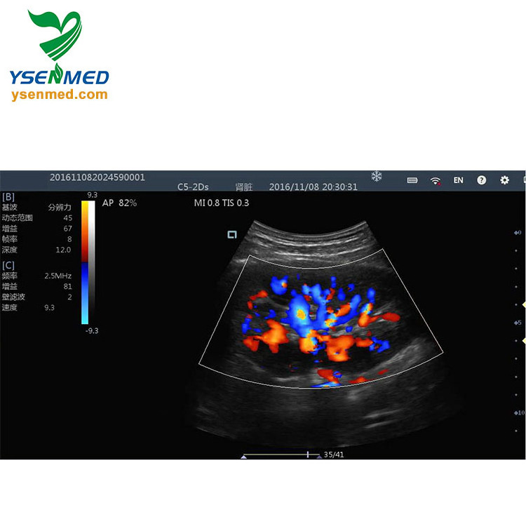 YSB363 Ysenmed color doppler wireless ultrasound probes portable high frequency best handheld portable wireless ultrasound