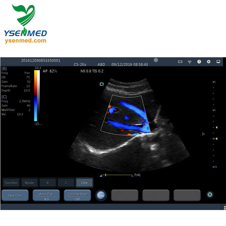 YSB363 Ysenmed color doppler wireless ultrasound probes portable high frequency best handheld portable wireless ultrasound